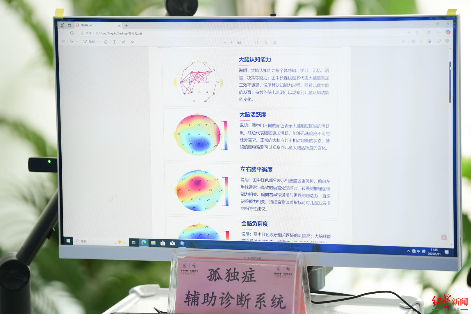 信部未来产业“揭榜挂帅”单位“成都造”用脑机接口技术造福孤独症儿童(图6)